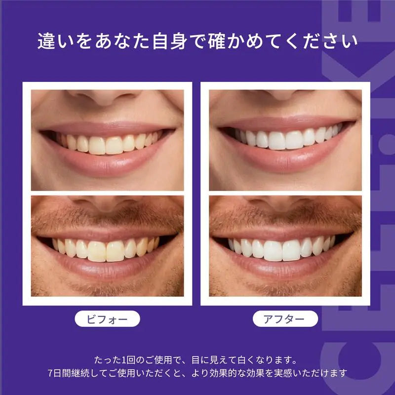 CEELIKE ホワイトニングストリップ｜高額なホワイトニング治療にさようなら